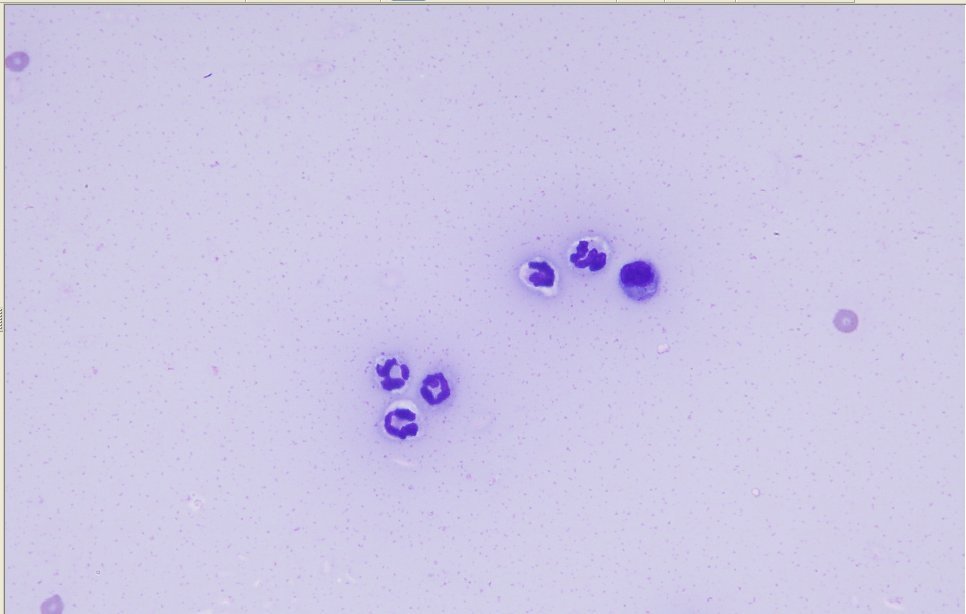 FIP cytology